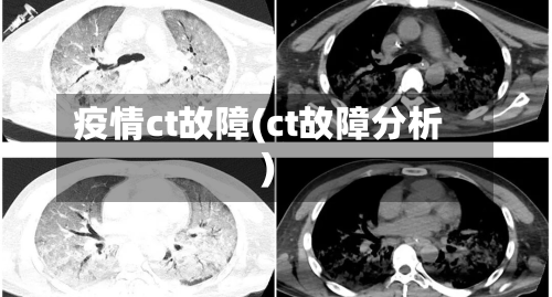 疫情ct故障(ct故障分析)