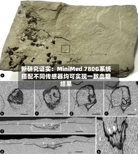 新研究证实：MiniMed 780G系统搭配不同传感器均可实现一致血糖结果