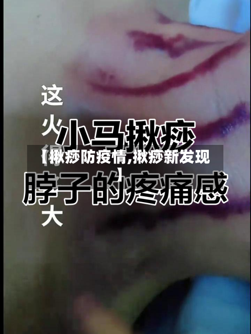 【揪痧防疫情,揪痧新发现】